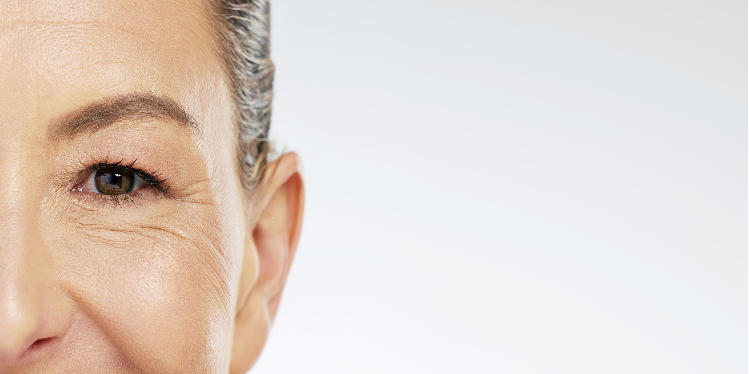 vieillissement peau pourquoi rides ridules Holinutria